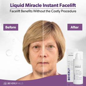 Beverly Hills applying serum under eye to reduce puffiness and smooth skin
