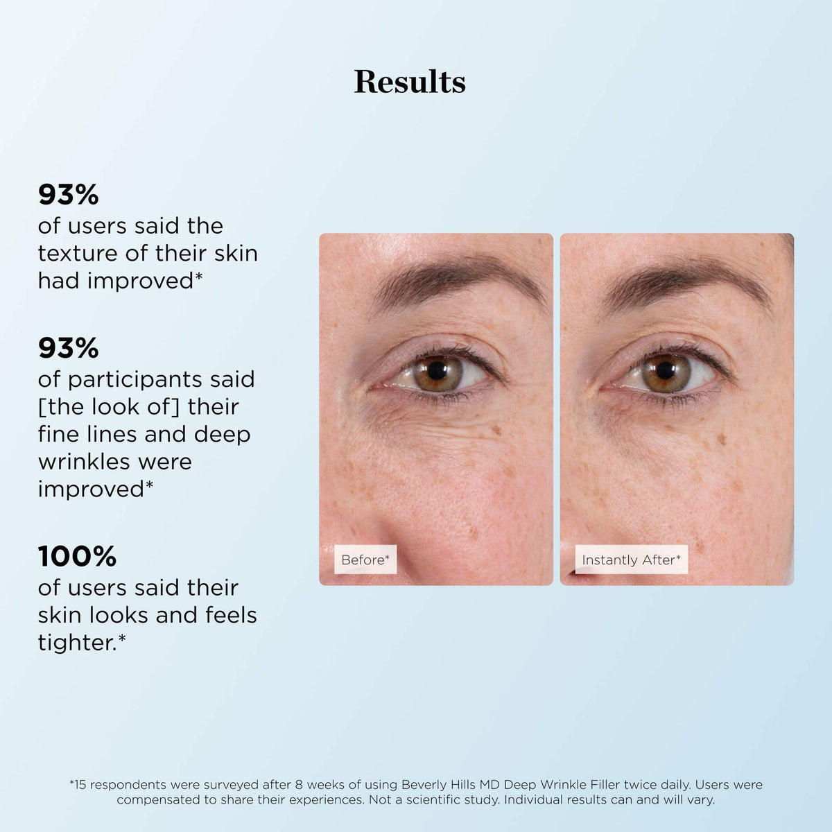 Beverly Hills MD before and after comparison showing reduced wrinkle appearance