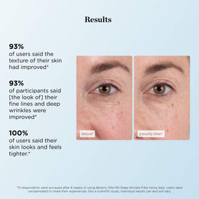 Beverly Hills MD before and after comparison showing reduced wrinkle appearance