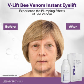 BEVERLY HILLS pipette dispensing serum onto fingertip for precise application