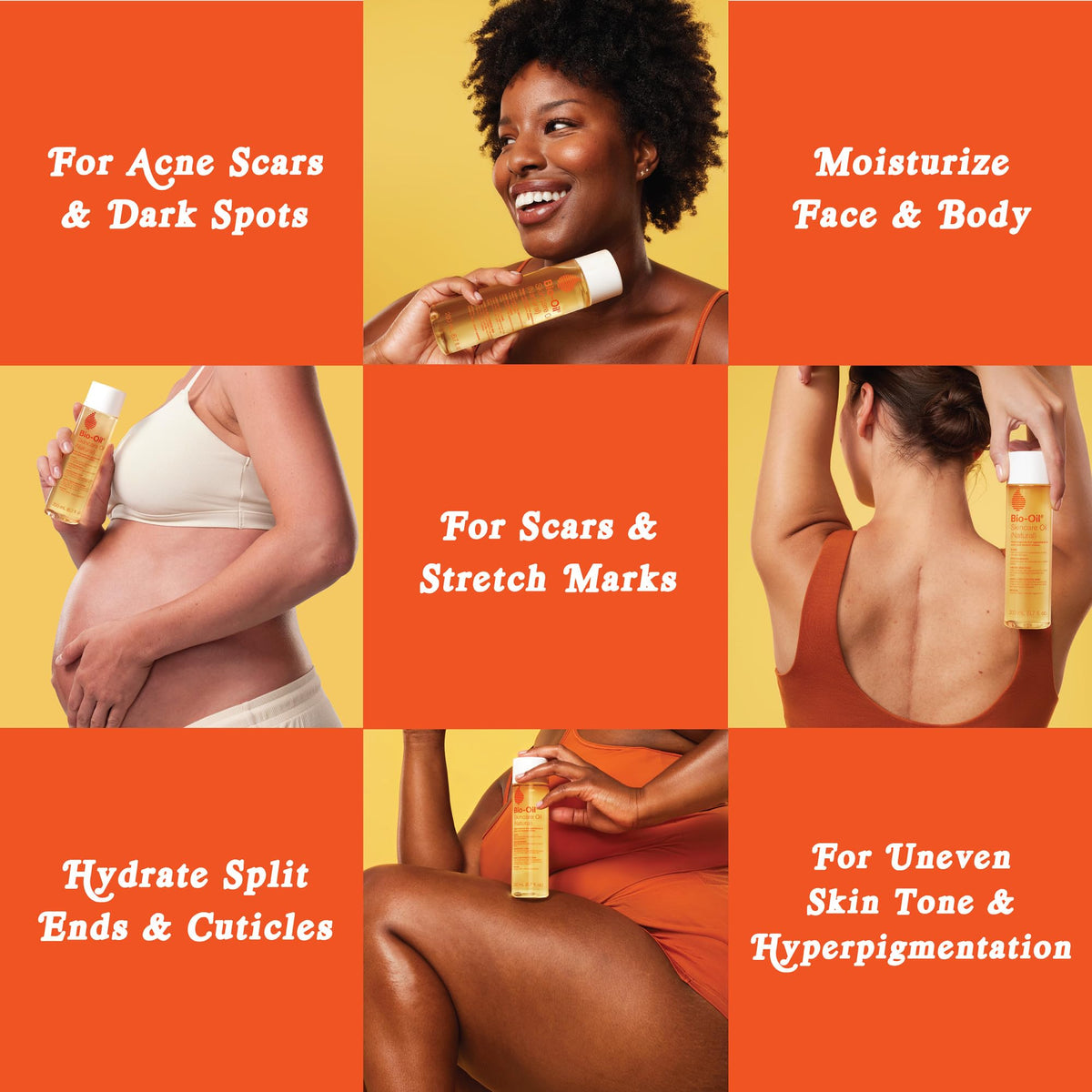 Bio-Oil being massaged onto belly, shows support for stretch mark hydration