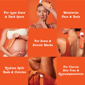 Bio-Oil label and ingredient panel detail, brand transparency supports informed use