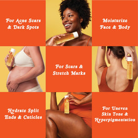 Bio-Oil being dispensed from bottle illustrating controlled application benefit