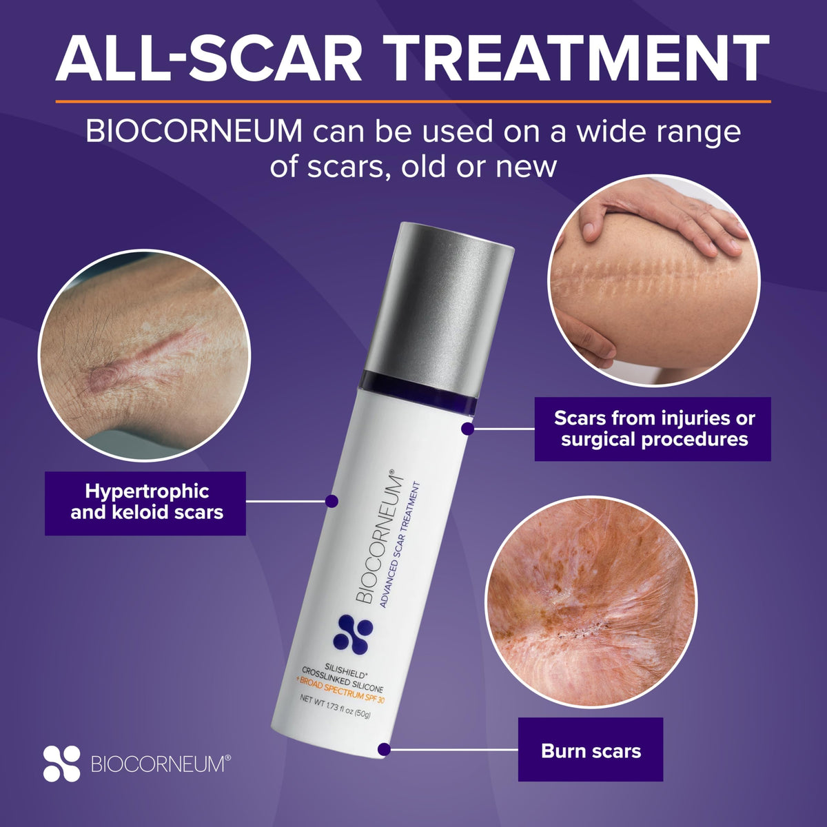 BIOCORNEUM film drying on skin illustrating protective breathable barrier