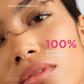Bioderma Sensibio gel turned to foam demonstrating gentle cleansing