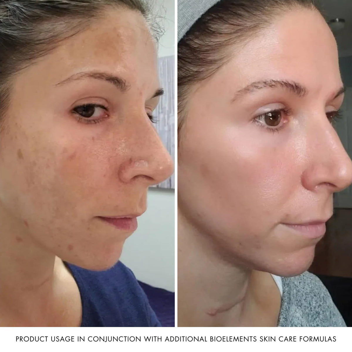 Bioelements tube shown with makeup items for balanced-skin prep benefit