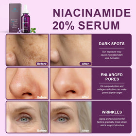 Bioglossy label and ingredient list showing 20% niacinamide concentration