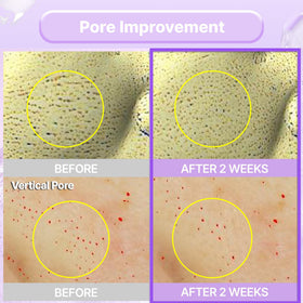 BIOHEAL BOH applied on cheek highlighting pore-tightening effect