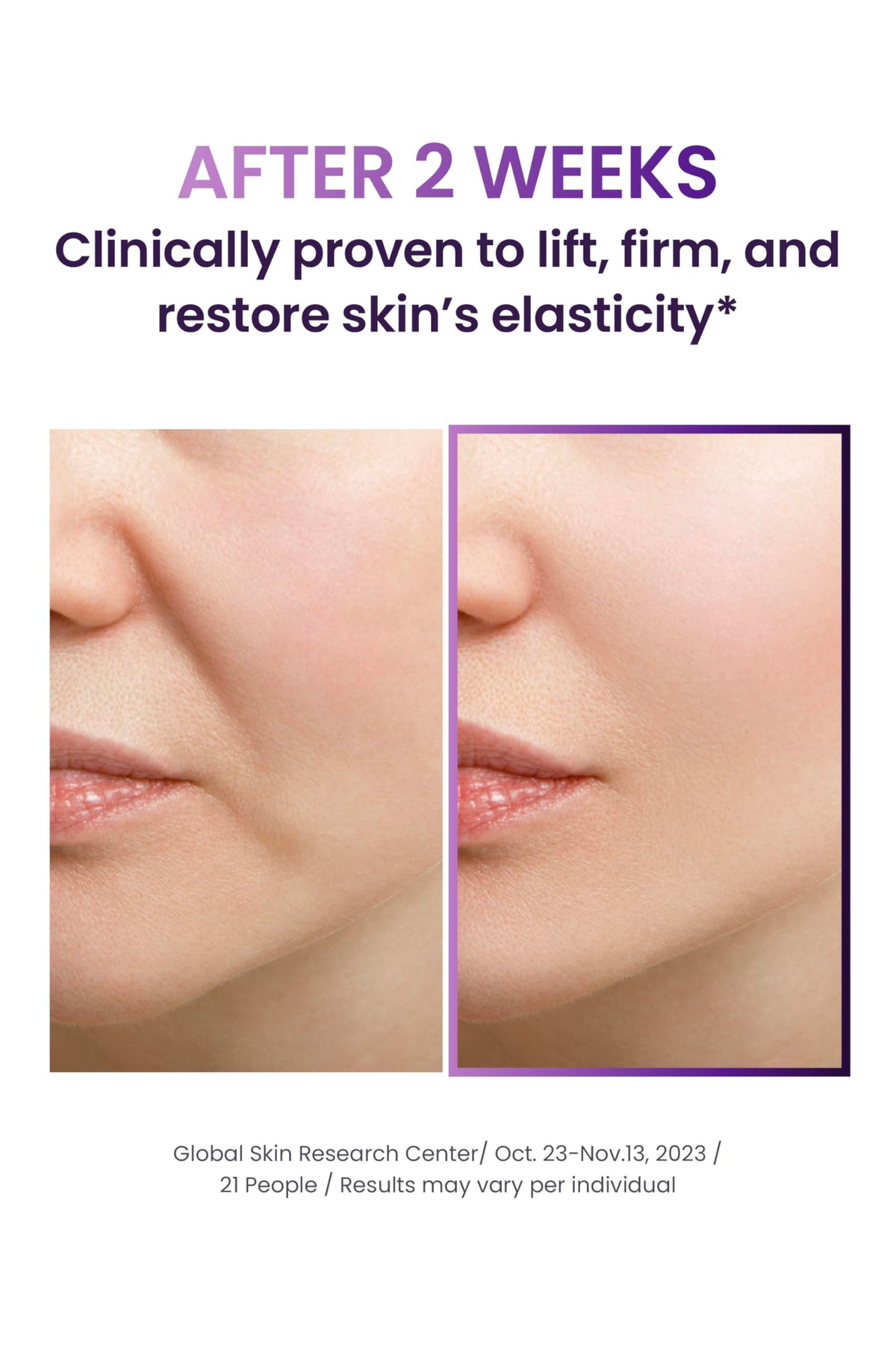 BIOHEAL BOH cream mist in action delivering instant moisture
