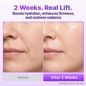 BIOHEAL BOH spray applied to neck and décolletage for even hydration