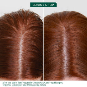 Biolage dropper applying a precise drop to scalp for controlled oil-reducing use