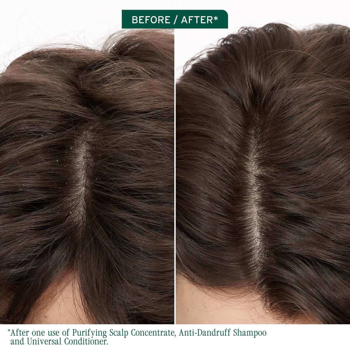 Biolage pump and cap detail highlighting recycled-plastic packaging benefit