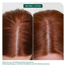 Biolage scalp sync shampoo texture closeup highlighting gentle foam and clarity