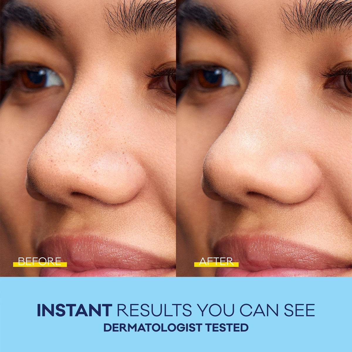 Bioré removed strip with captured blackheads showing deep clean