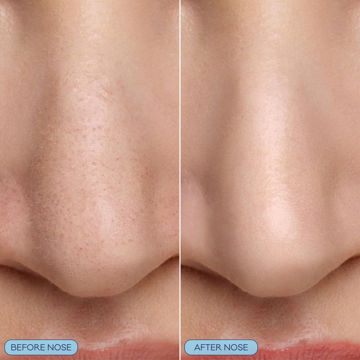 Bioré silicone scrubber detail showing gentle massage for clearer pores
