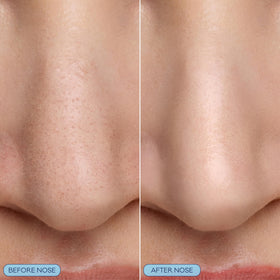 Bioré silicone scrubber detail showing gentle massage for clearer pores