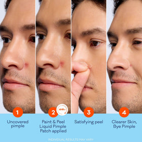 Bioré applying liquid to a blemish highlighting easy spot treatment and precision