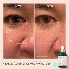 BIOSSANCE hand applying serum to show easy spread and non-greasy finish