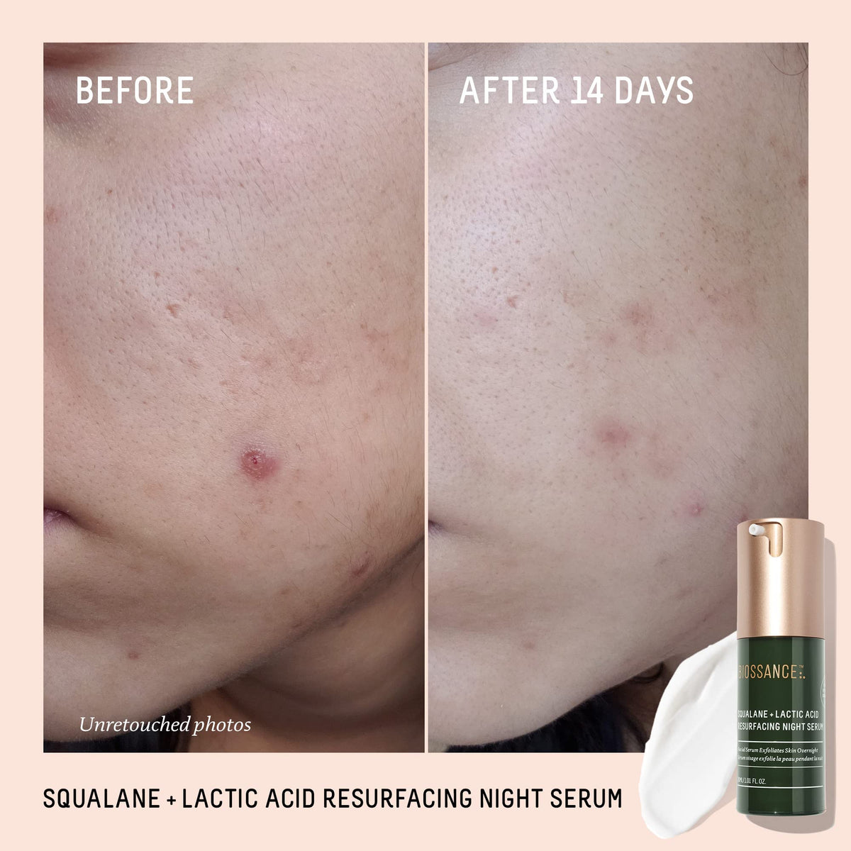 Biossance dropper dispensing serum texture demonstrating smooth, hydrating consistency