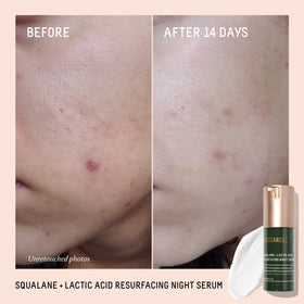 Biossance dropper dispensing serum texture demonstrating smooth, hydrating consistency