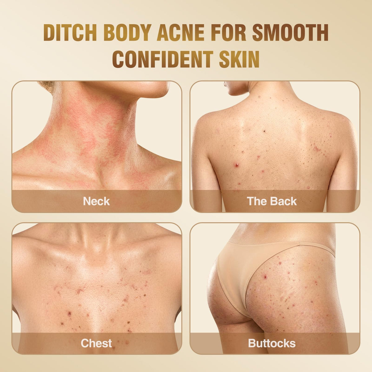 BIYSBER comparative texture image showing reduced bumps and smoother skin