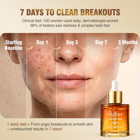 BIYSBER serum dropper releasing lightweight texture for easy absorption