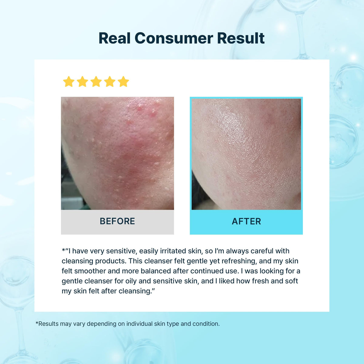 BLANC NATURE applying foam to face demonstrating gentle massage and oil removal benefit