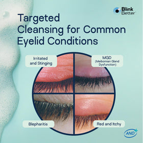 BlinkBetter application demonstration cleaning lashes and lids for hygiene benefit