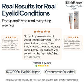 BlinkBetter cream on bathroom shelf in lifestyle setting suggesting daily routine benefit