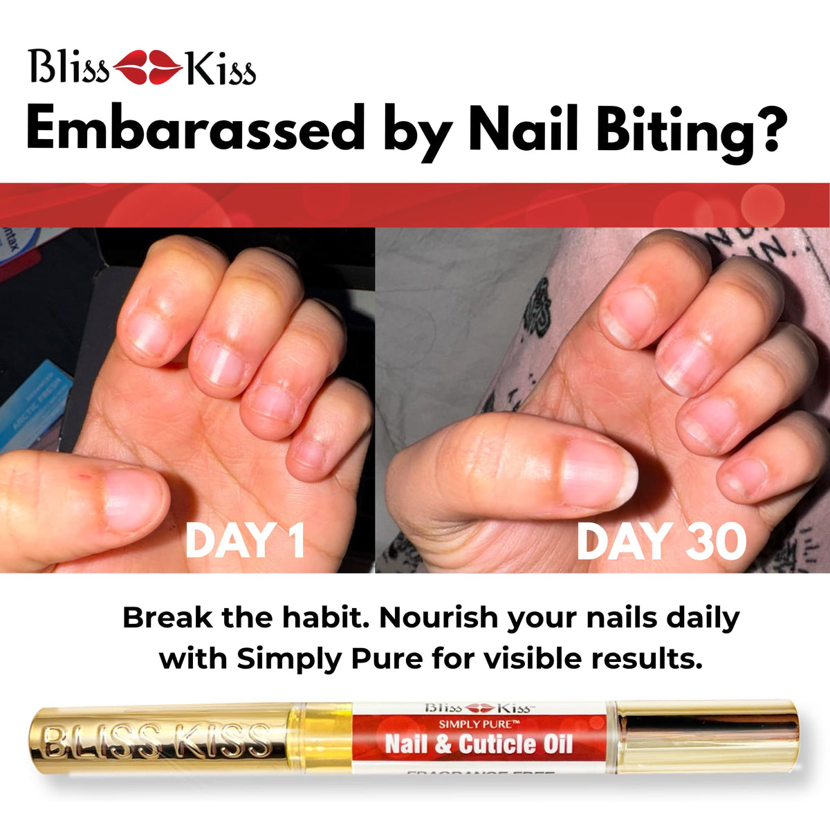 Bliss Kiss close-up pen tip demonstrating precise, mess-free cuticle application