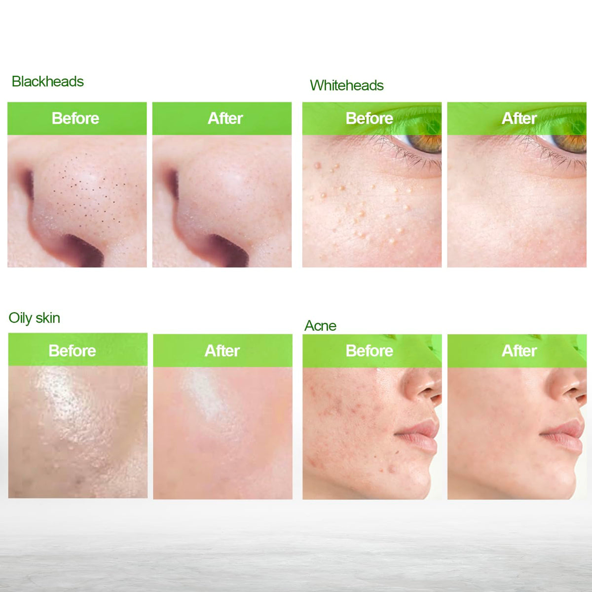 Blooskim peeling action close-up showing lifted debris for visible pore clarity