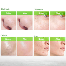 Blooskim peeling action close-up showing lifted debris for visible pore clarity