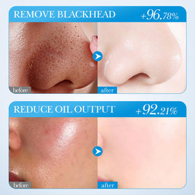 Blopuivo close-up of rose stick texture showing smooth application and soothing benefits