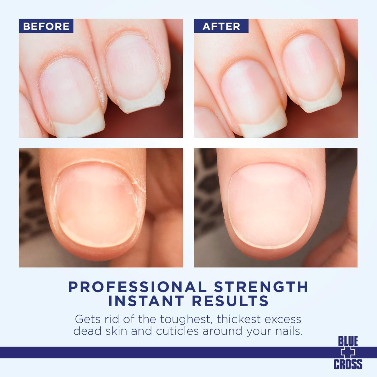 Blue Cross close-up of thin milky liquid texture showing easy spread benefit