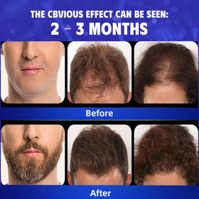 Blue Sea Sky precision dropper tip close-up for targeted scalp application