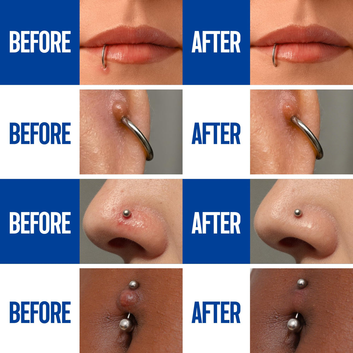 Person misting a nose piercing with BodyJ4You for precise, touch-free care