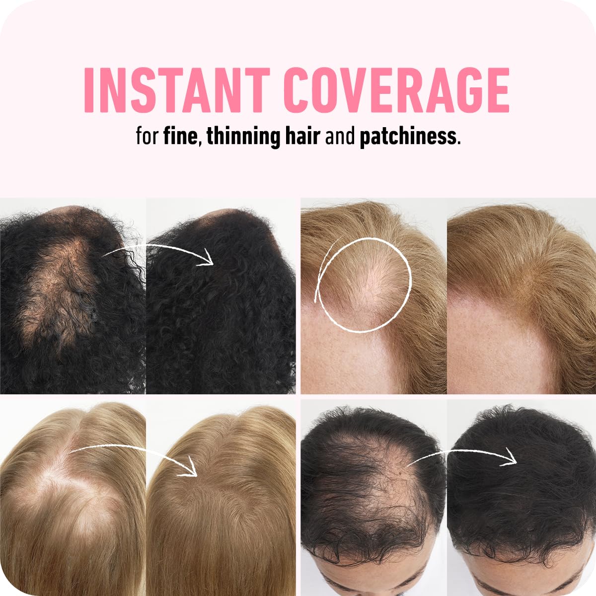 Boldify fibres applied to part demonstrating immediate coverage and fuller-looking hair