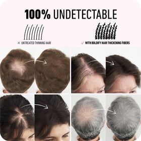 Boldify before and after crown comparison showing thicker appearance