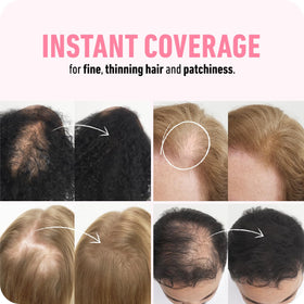 Boldify fibers being applied to scalp for quick, fuller-hair appearance