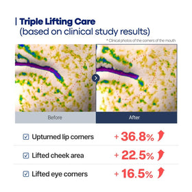 Person applying BONCEPT under-eye cream demonstrating gentle application benefit