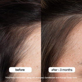 bondiboost label close-up highlighting Procapil Redensyl and botanical actives