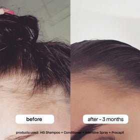 BONDIBOOST mist applied to scalp demonstrating quick absorption benefit