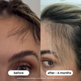 BONDIBOOST applying serum to scalp illustrating targeted delivery and scalp nourishment