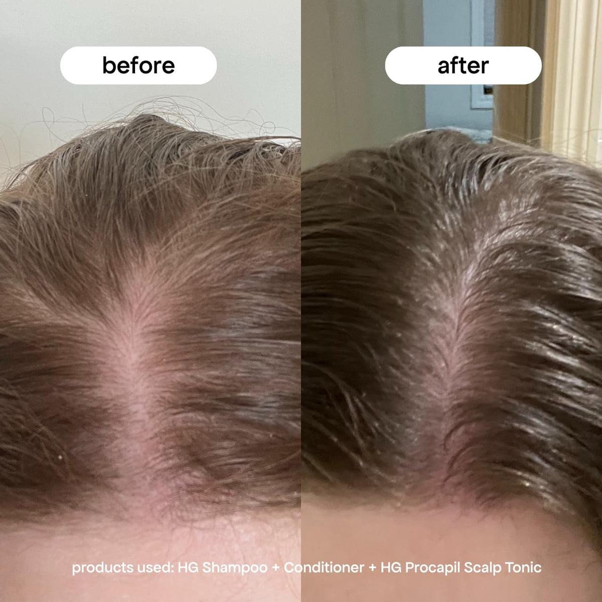 BONDIBOOST lightweight serum texture on hand demonstrating fast absorption benefit