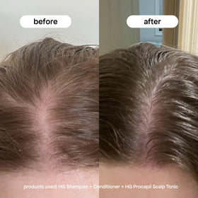 BONDIBOOST lightweight serum texture on hand demonstrating fast absorption benefit
