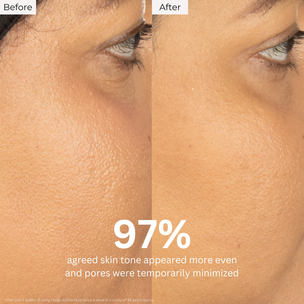 Borghese mud being applied to cheek showing targeted pore purification