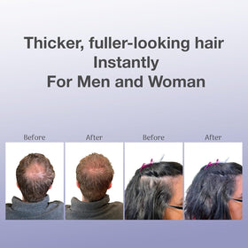 BosleyMD before and after comparison demonstrating fuller, thicker appearance