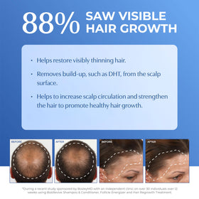 BosleyMD BosRevive pump dispenser close-up for easy, mess-free dispensing