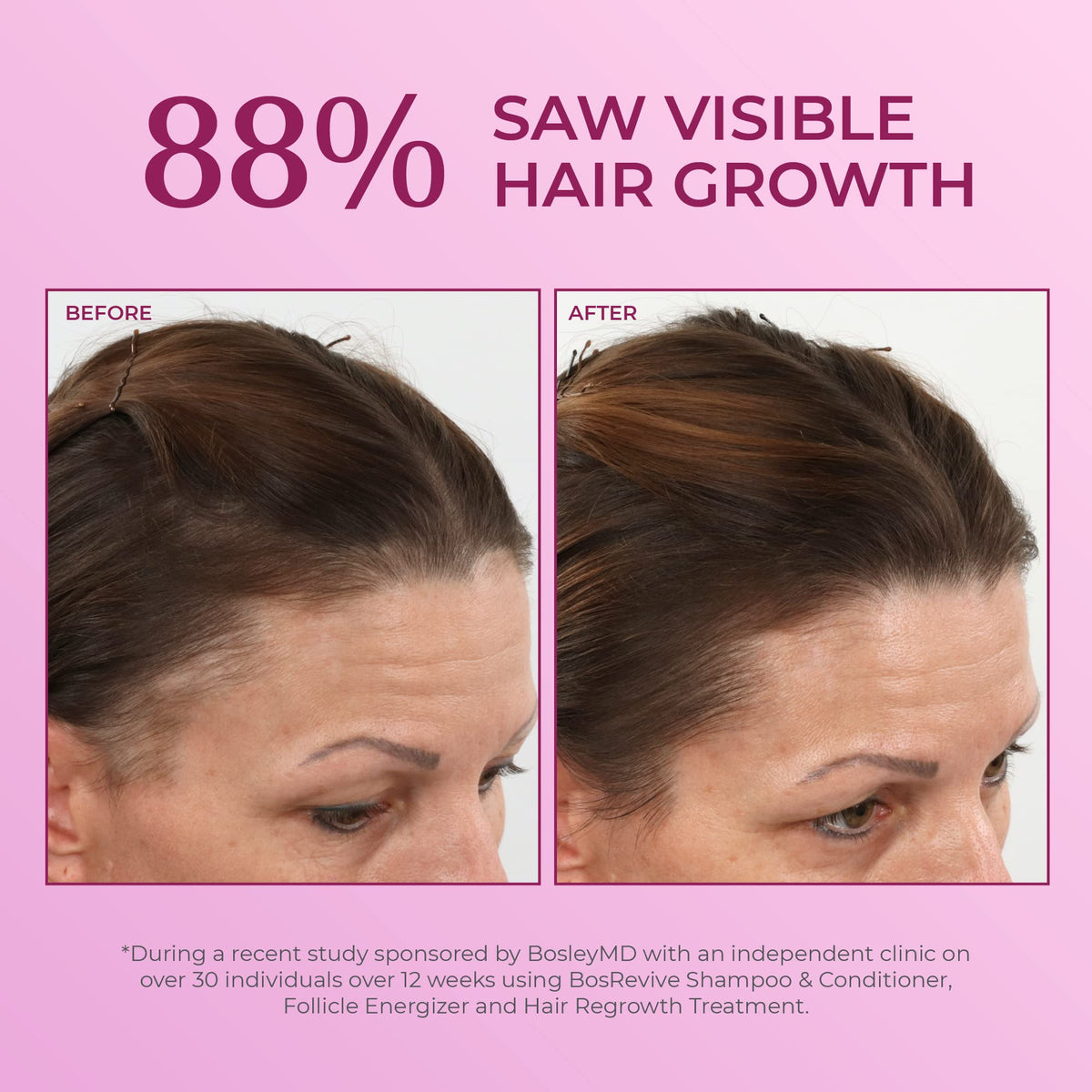 BosleyMD close-up of clear solution texture highlighting gentle formulation