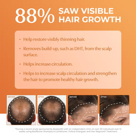 BosleyMD conditioner cream texture highlighting hydration for smoother, stronger hair
